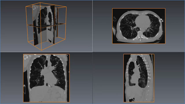 Multiple orthoslices