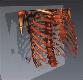 Shadows: medical data