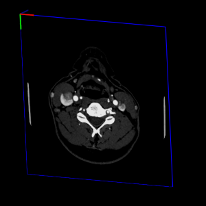 DICOM image position without SoMatrixTransform