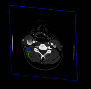 DICOM image position with SoMatrixTransform