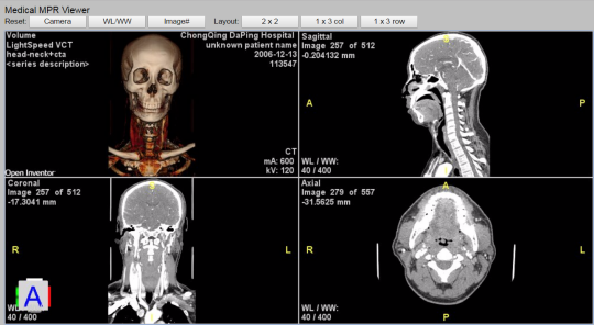 MedicalMPRViewerRemote.png