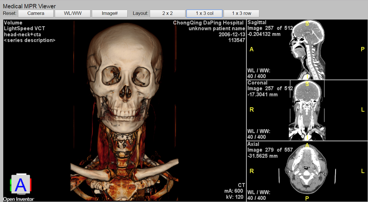 MedicalMPRViewerRemote_c.png