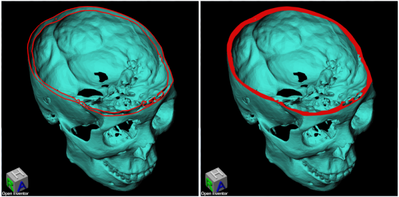 cappingGeometry_b.png