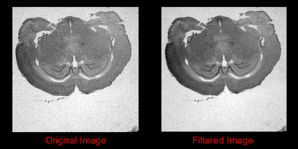 Denoising a 2D image