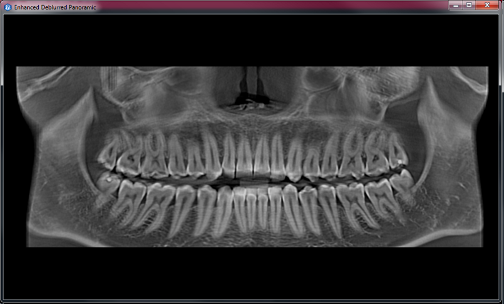 medicalDentalAutomaticPanoramic.png