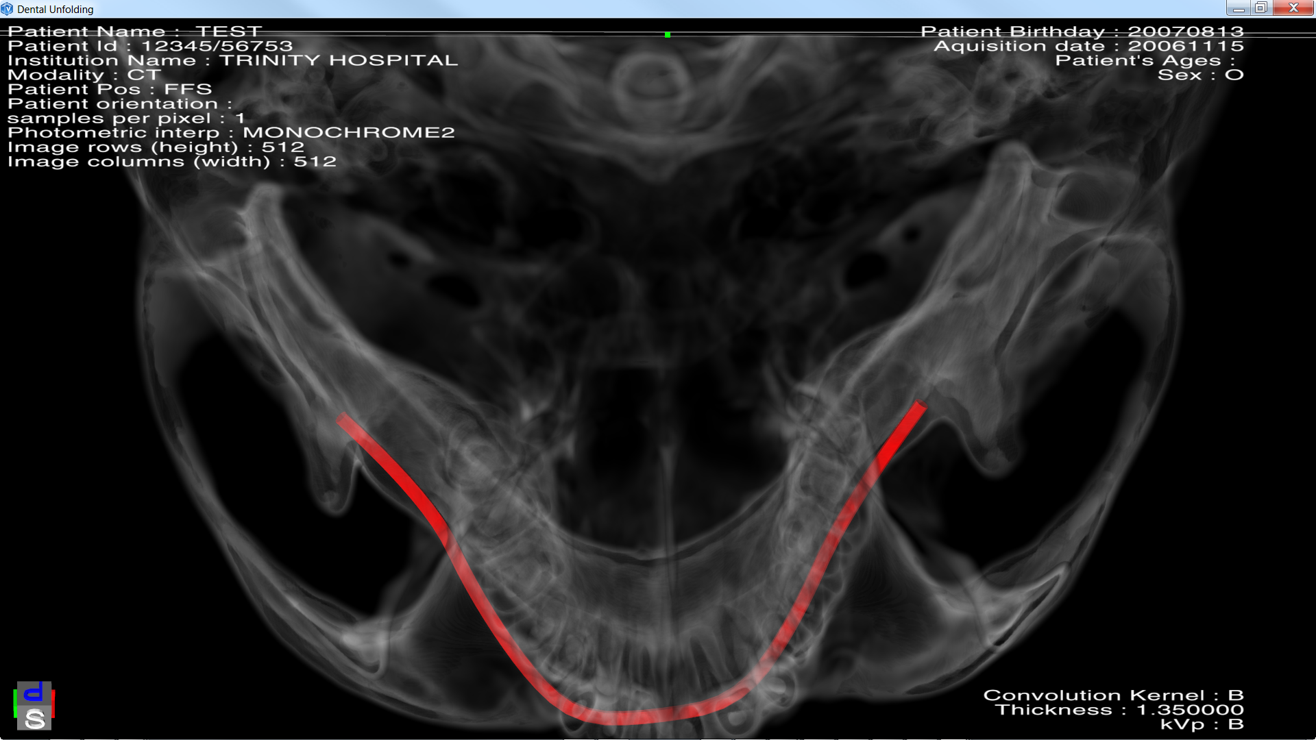 medicalDentalCurveUnfolding_1_b.png