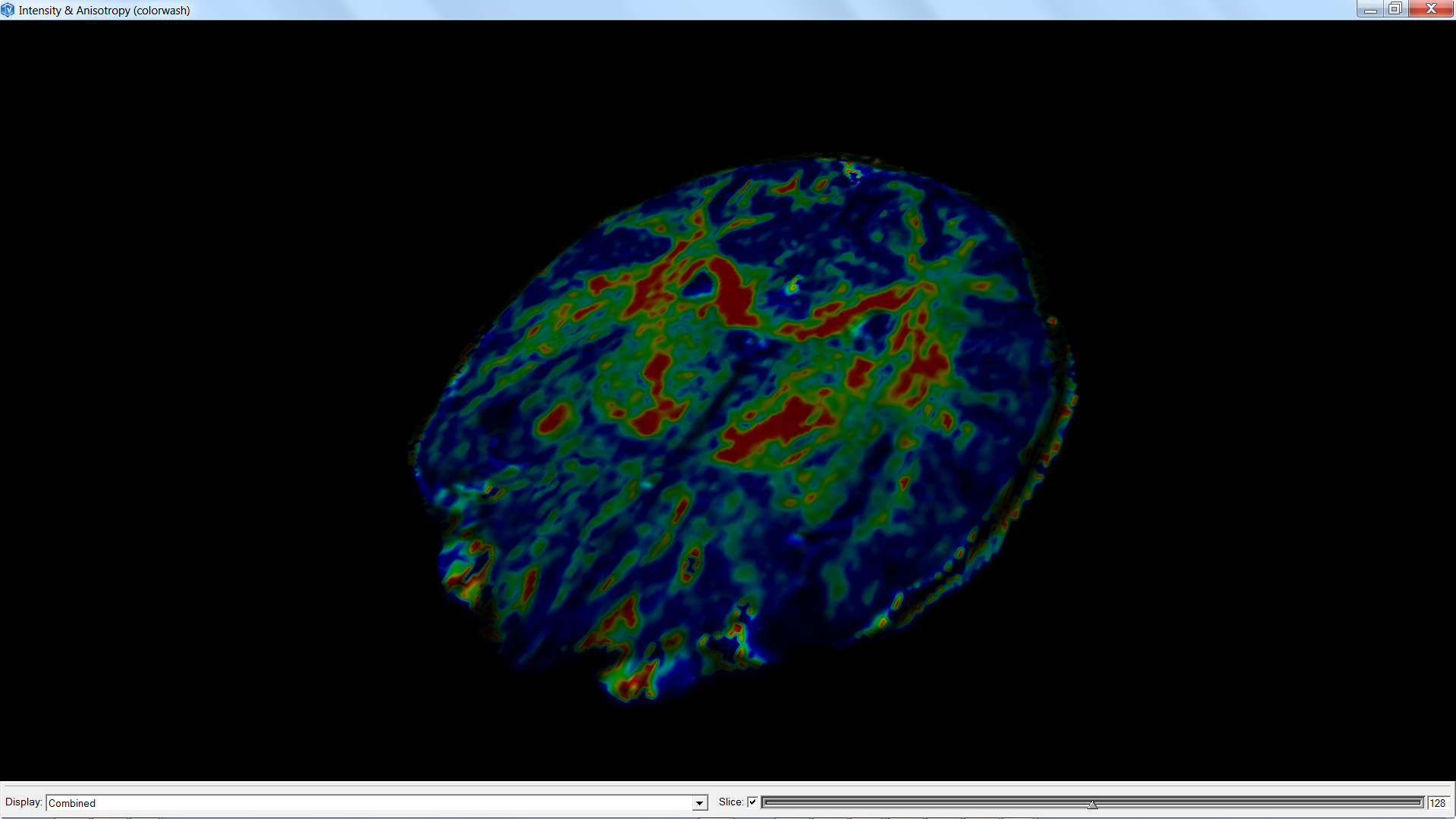 medicalIntensityAnisotropy_b.png