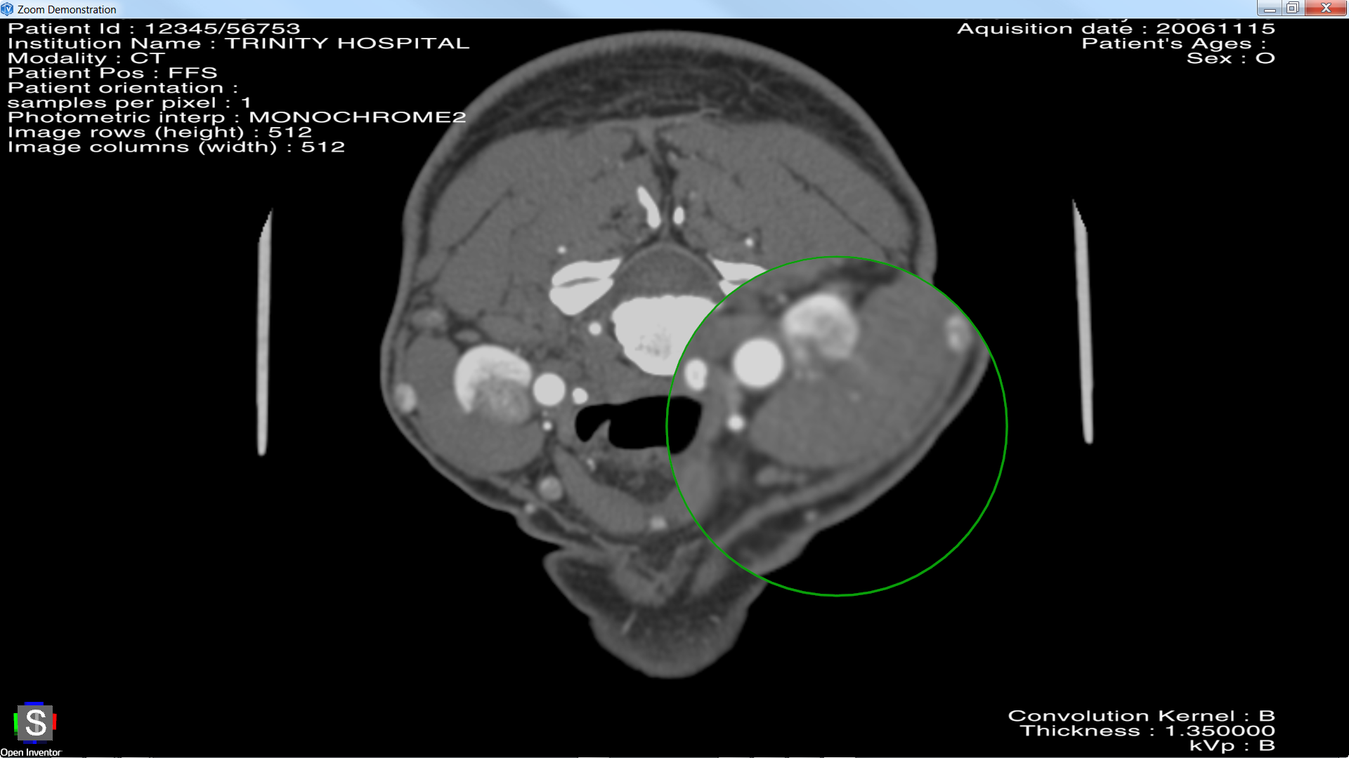 medicalMagnifier_b.png