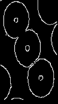 Figure3: Threshold by hysteresis