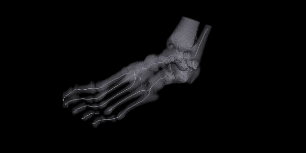 Centerline extraction from foot bones